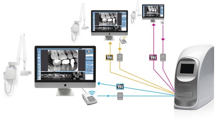 Scanner ai fosfori proscanner planmeca